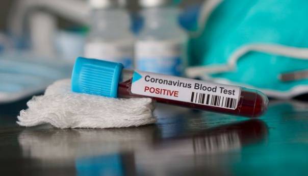 U zadnja 24 sata u BiH još 231 novozaraženi koronavirusom