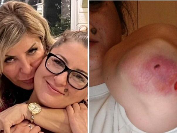 Uhapšen član "Pantera" zbog sumnje da je pretukao kćerku Džemile Talić Gabriel