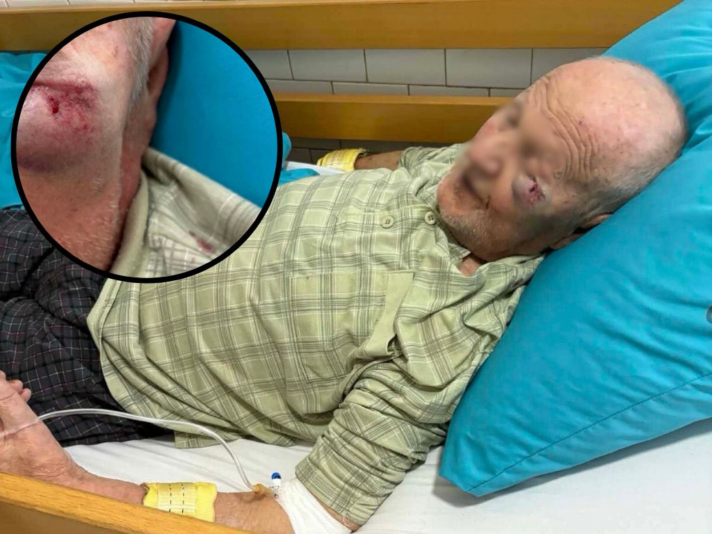 Uznemirujuće: Ovako izgleda starac (84) koji je napadnut u Bolnici Gračanica
