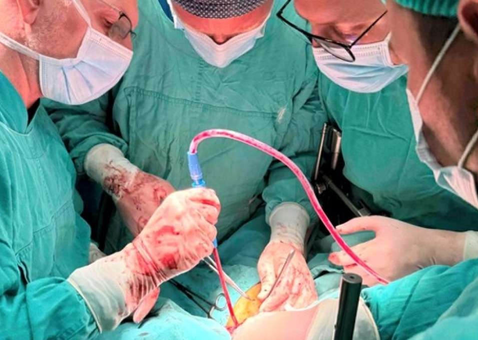 Veliki iskorak u Zenici: Prvi put uspješno izvedena složena operacija raka jednjaka