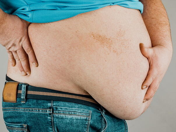 Više od dvije milijarde ljudi bit će gojazno do 2030.