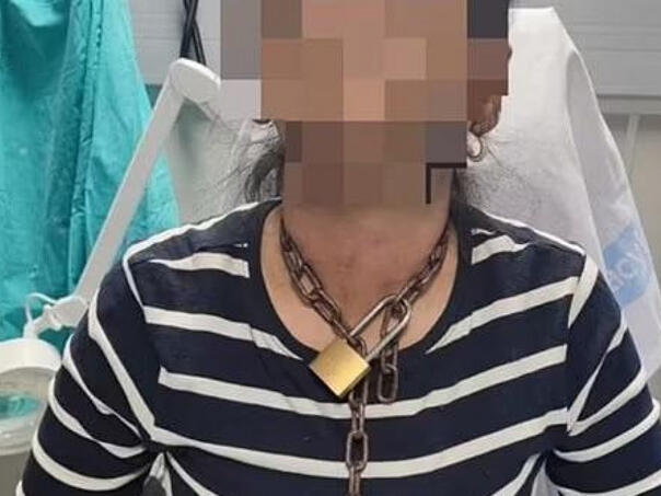 Žena se pojavila u bolnici s lancem oko vrata, pozadina priče uznemiravajuća