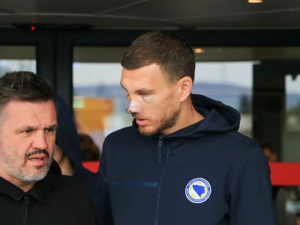 Zmajevi sletjeli u Sarajevo, Džeko izgleda neprepoznatljivo