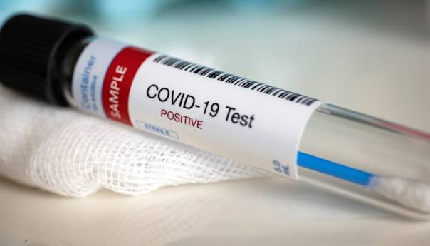 Znatan pad broja zaraženih virusom korona